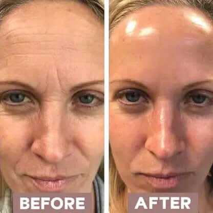 Collagen Masks - PriPedi
