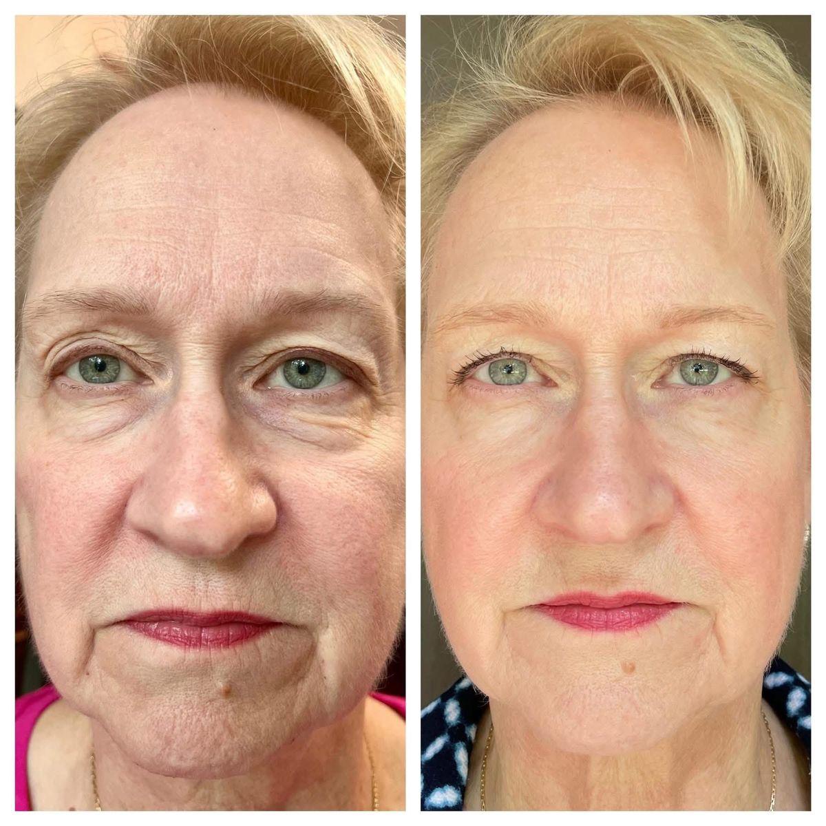 L'originale Bio-Adaptive Technology