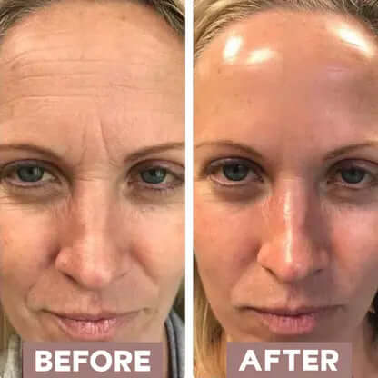 Collagen Masks - PriPedi