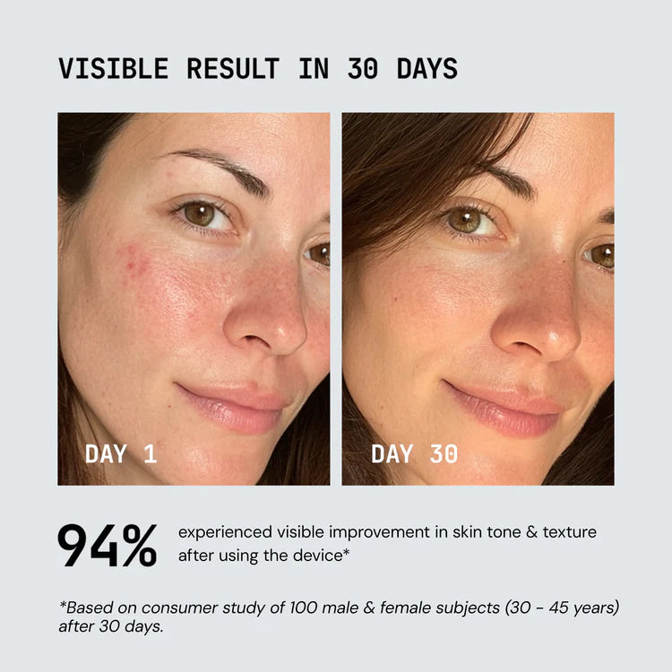 Pripedi - Red Light Therapy Device