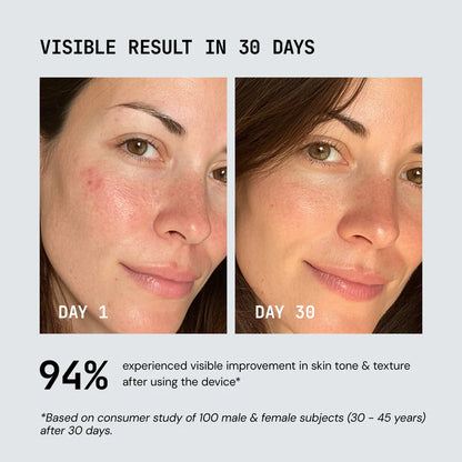 Pripedi - Red Light Therapy Device